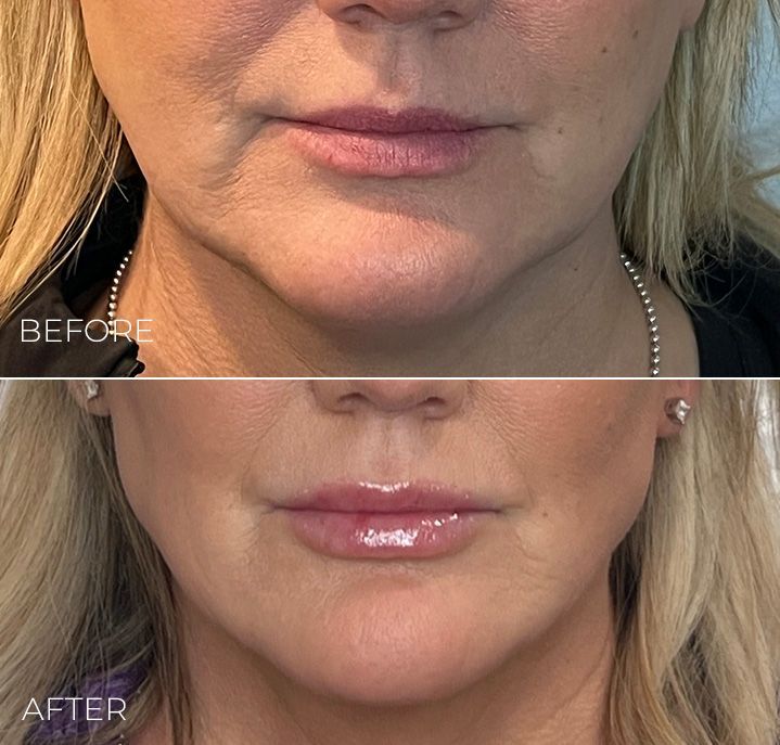 A before and after photo of a woman 's face