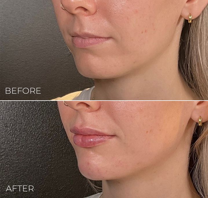 A before and after photo of a woman 's face.