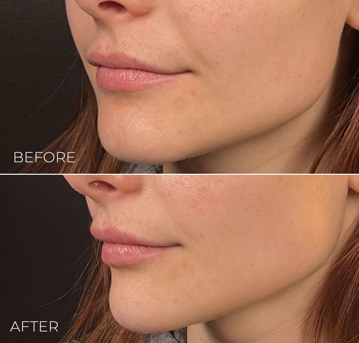 A before and after photo of a woman 's face