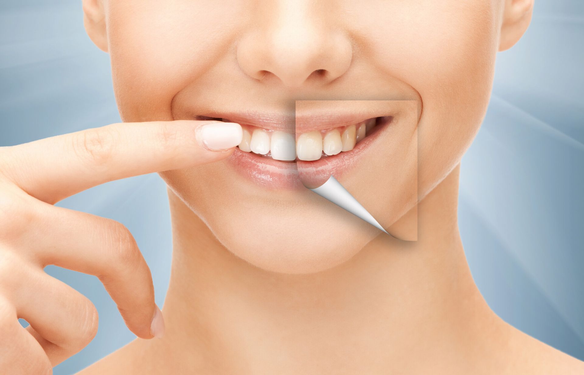 Teeth Whitening by Dentist in West Harwich Ma