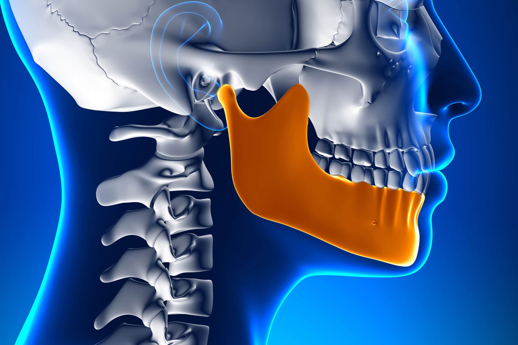 human jaw sculpture xray