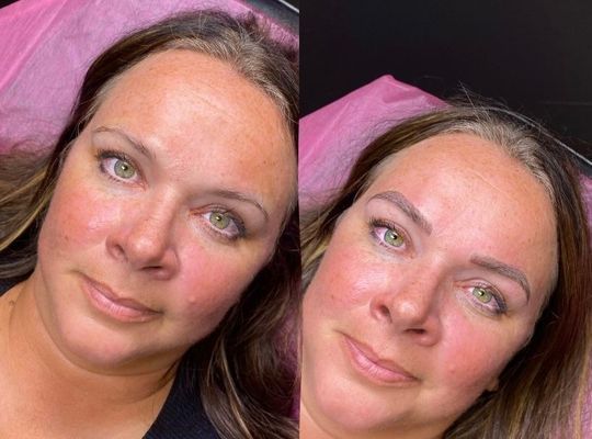 Blade to Beauty Eyebrow Microblading Before and After
