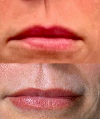 Blade to Beauty Lip Blush