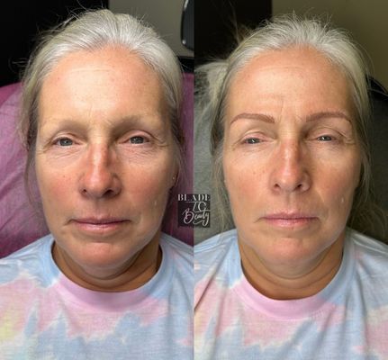 Blade to Beauty Eyebrow Microblading Before and After
