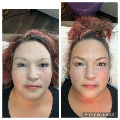 Blade to Beauty Eyebrow Microblading Before and After