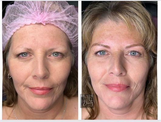 Blade to Beauty Eyebrow Microblading Before and After