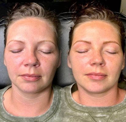 Blade to Beauty Eyebrow Microblading Before and After