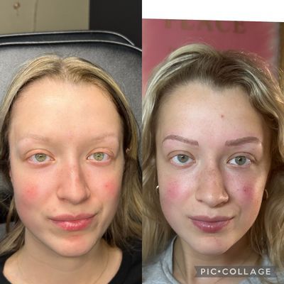 Blade to Beauty Eyebrow Microblading Before and After