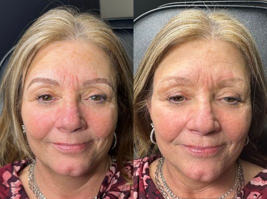 Blade to Beauty Eyebrow Microblading Before and After