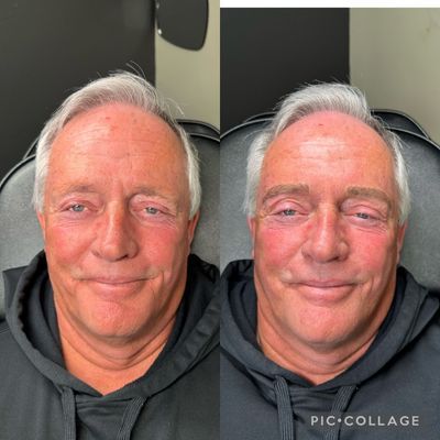 Blade to Beauty Eyebrow Microblading Before and After