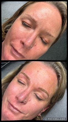 Blade to Beauty Eyebrow Microblading