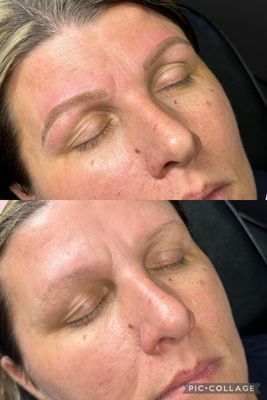Blade to Beauty Eyebrow Microblading