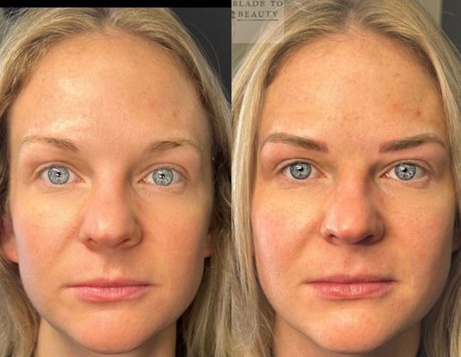 Blade to Beauty Eyebrow Microblading Before and After