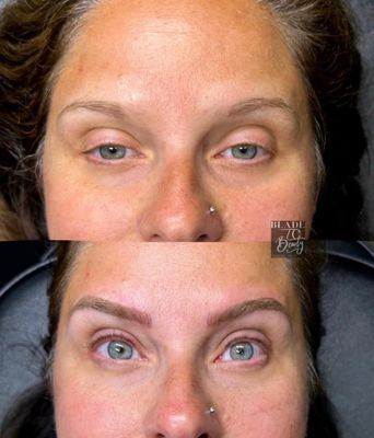 Blade to Beauty Eyebrow Microblading Before and After