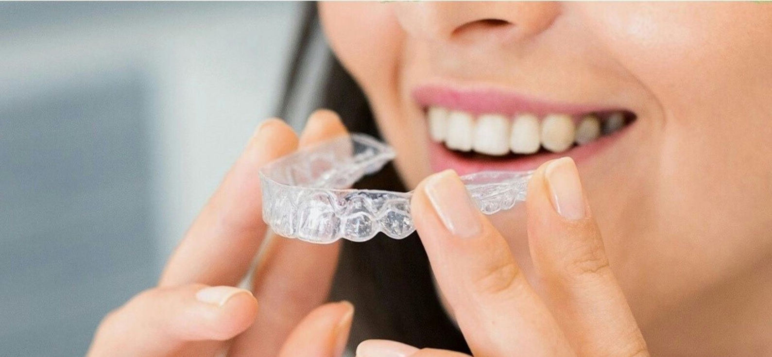 Teeth Straightening Bankstown | Clear Aligners
