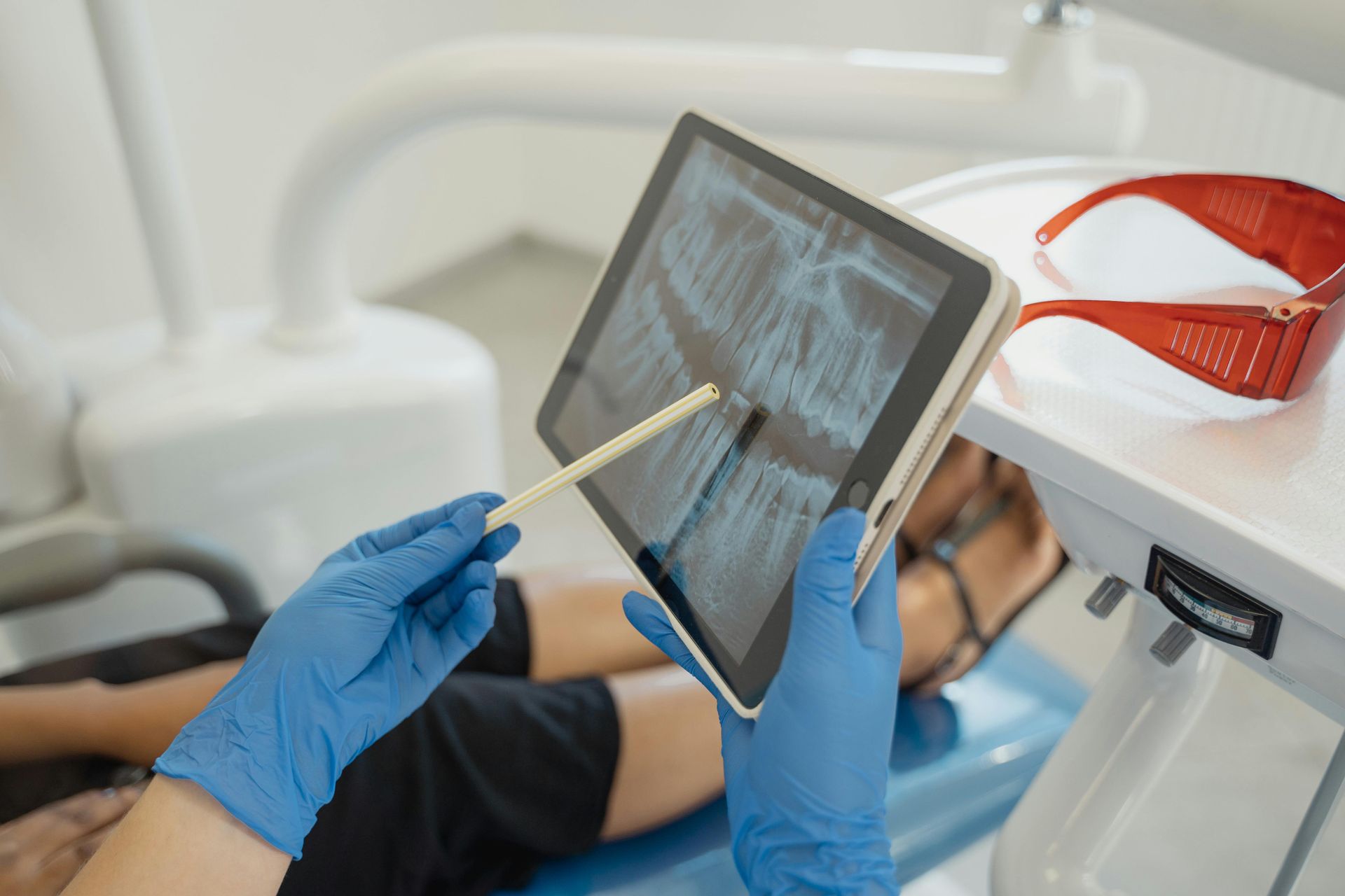 root canal bankstown