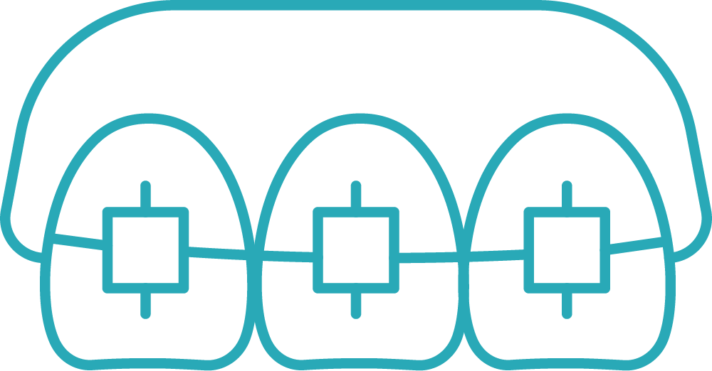 A line drawing of three teeth with braces on them.