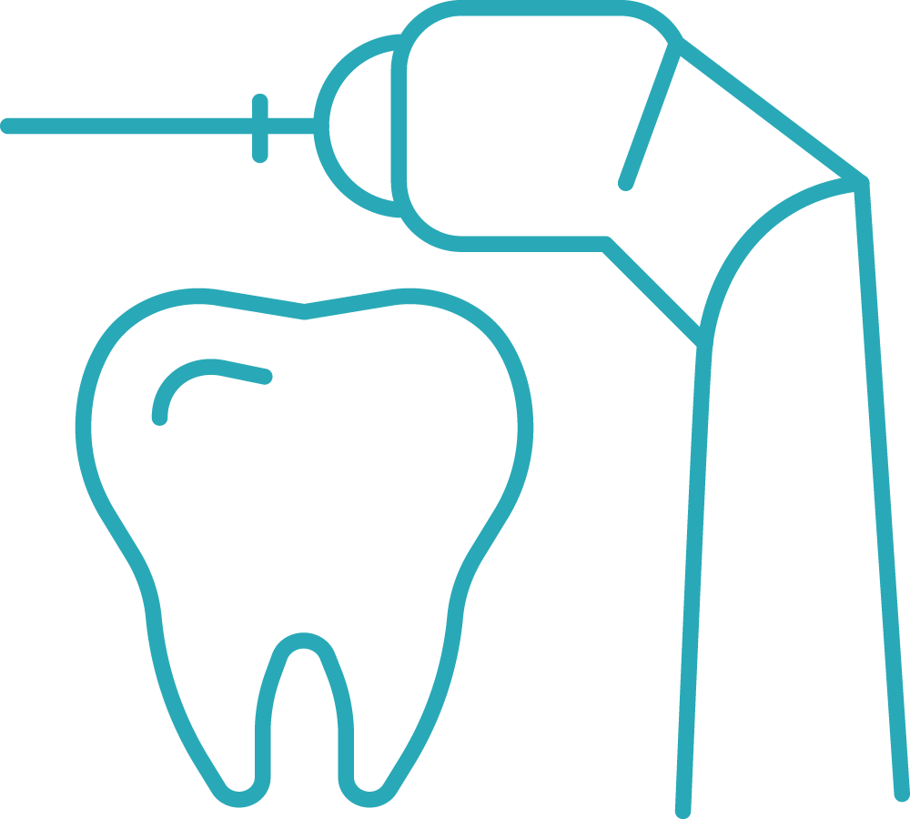 A line drawing of a tooth being drilled with a drill.