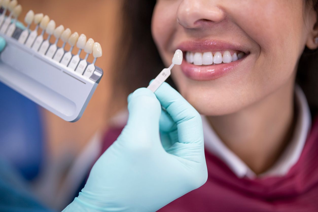 Dentist comparing shade guide to patient's teeth during a cosmetic dentistry consultation.
