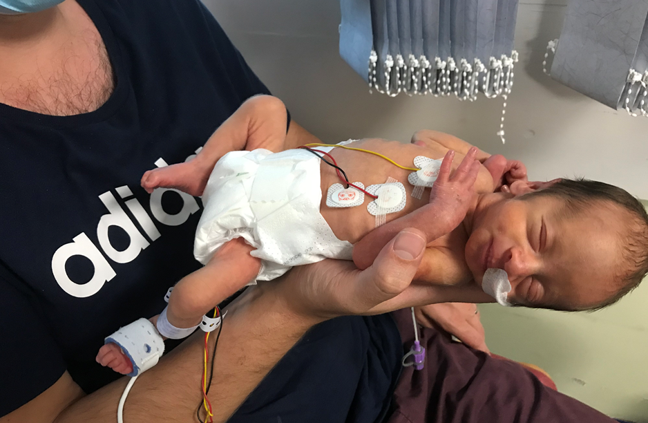 Premature baby born at 32 weeks
