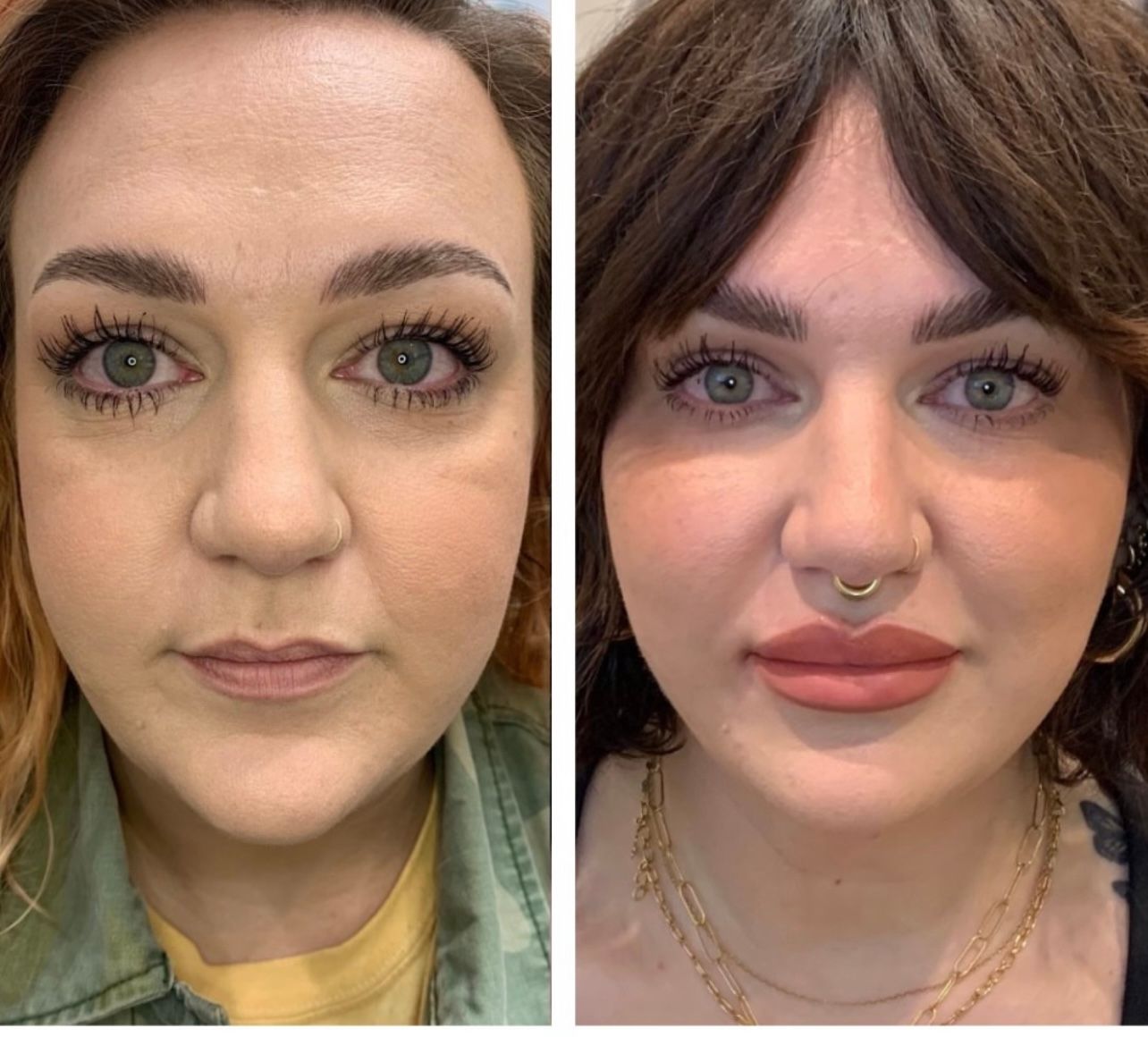 Before-and-after facial comparison. Woman's face with less fullness on left, fuller lips and nose ring on right.