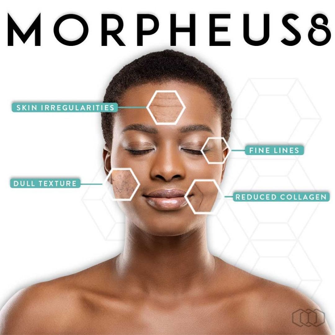 Morpheus8 facial treatment graphic, showing a woman's face with highlighted skin concerns: fine lines, dull texture, skin irregularities, reduced collagen.