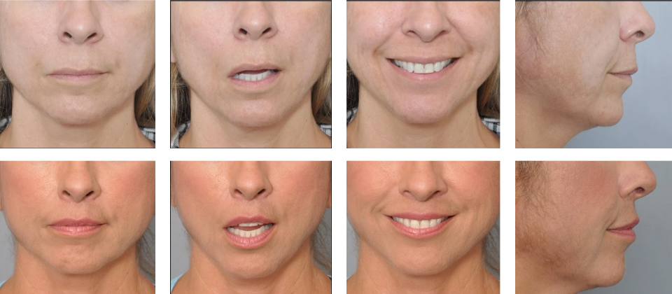 Eight views of a person's mouth and profile; neutral, open, and smiling expressions.