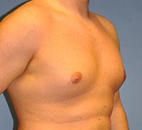 Torso of a person with a rounded chest. The skin is light-toned.