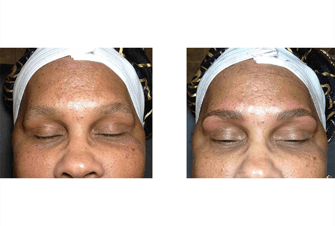 Two close-up photos side by side: before and after eyebrow microblading. A woman's face with closed eyes.