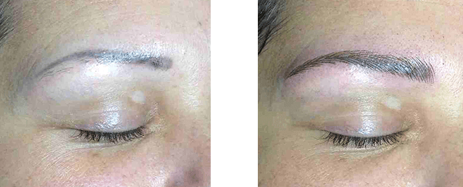 Comparison of before and after eyebrow micropigmentation; closed eyes with dark arched brows.