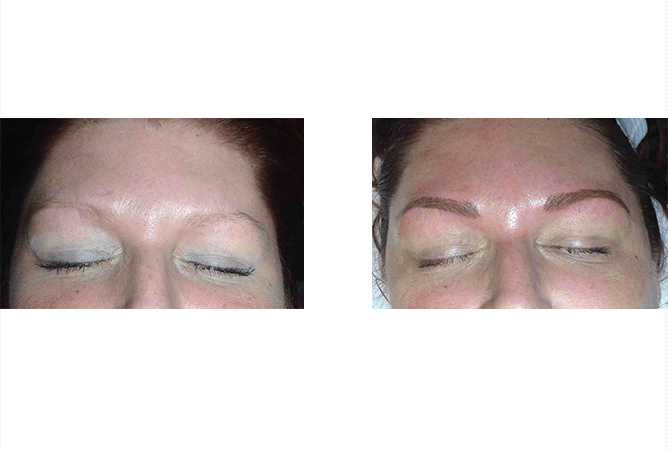 Eyebrow microblading before and after: Sparse brows filled in, more defined shape.