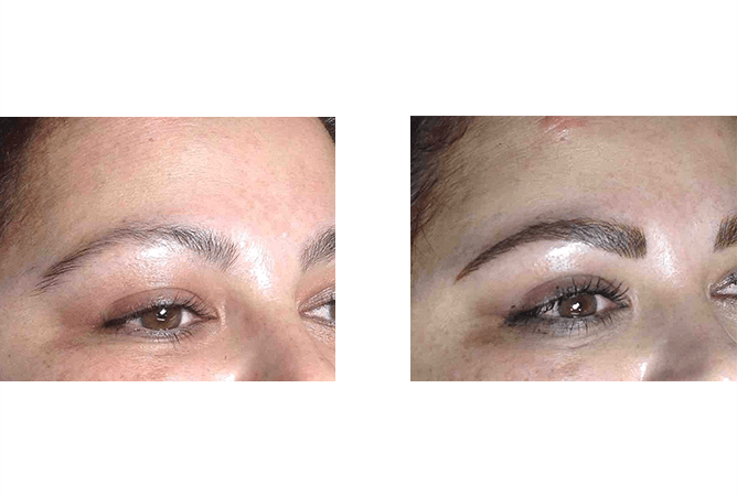 Before and after close-up of eyebrows. Left: sparse, light. Right: full, dark, defined brows.