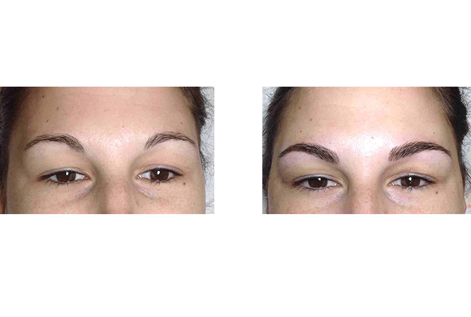 Before and after photos showing eyebrow transformation, from sparse to filled-in and defined.