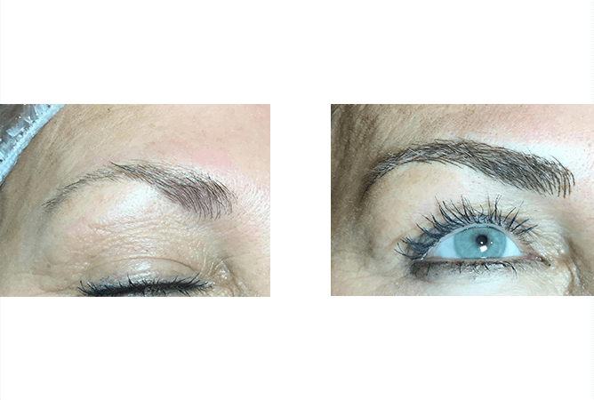 Before and after: Eyebrows improved with semi-permanent makeup. Darker, defined brows, open eyes.
