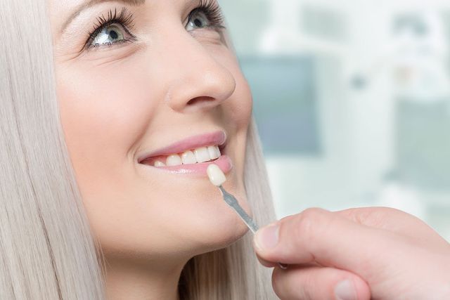 5 Signs You are a Good Candidate for Dental Veneers