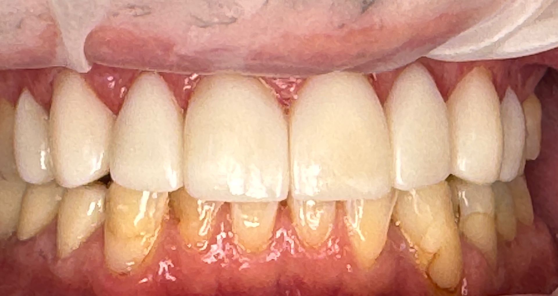 Close-up of a smiling person's teeth, showing a gap between the front teeth, pink gums, and red lips.