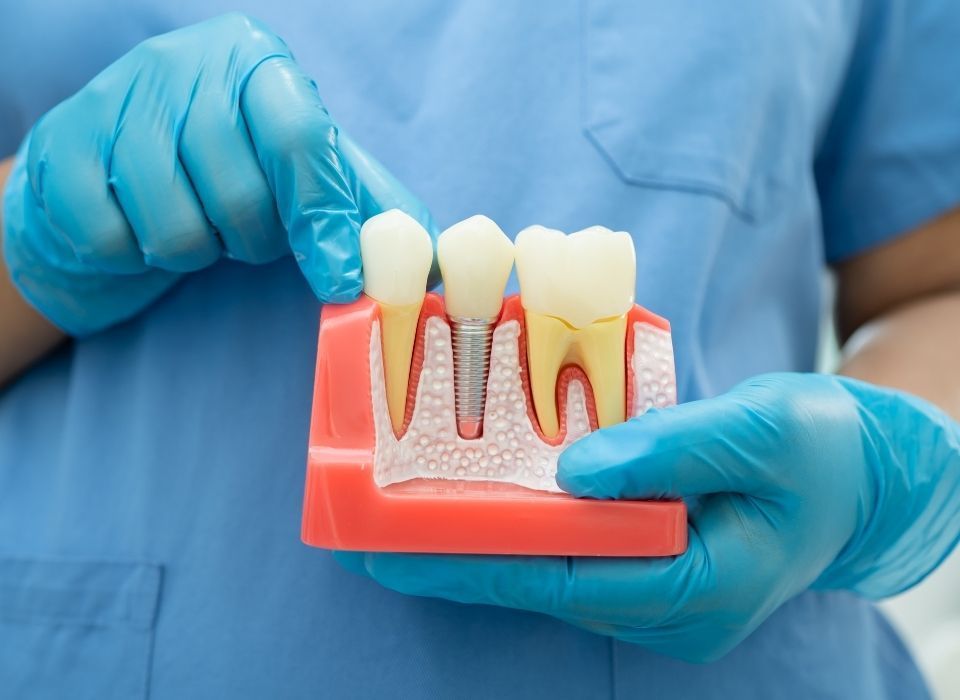 Dentist holding a model of teeth, showing an implant. Blue gloves, medical setting.