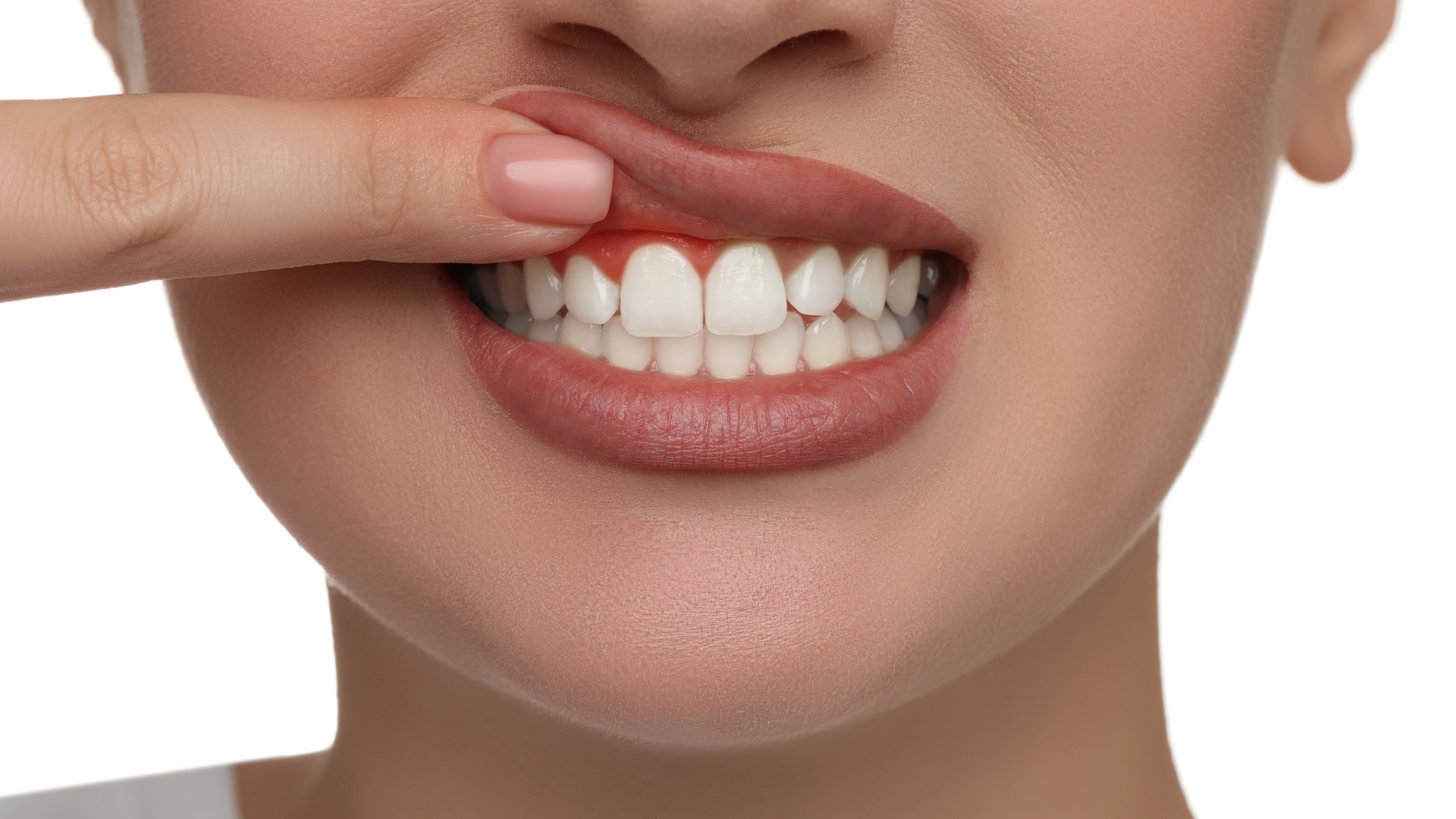 Woman pointing to inflamed, red gums.