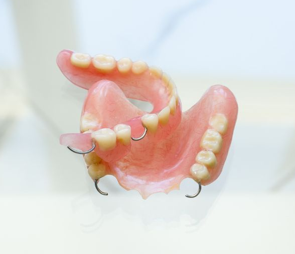 Dental partial denture, pink base with white teeth, held in place by wire clasps.