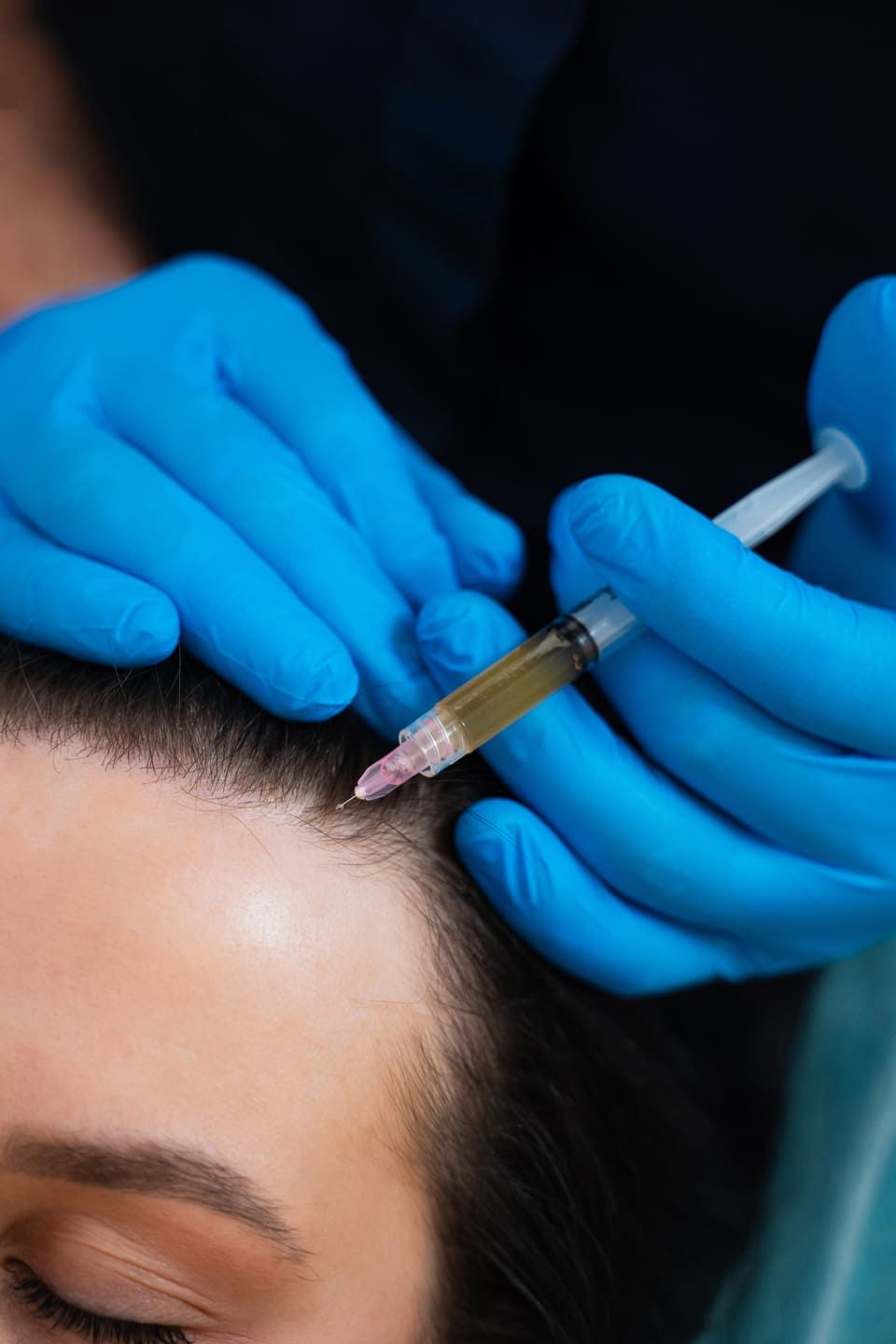Hair Restoration Therapy