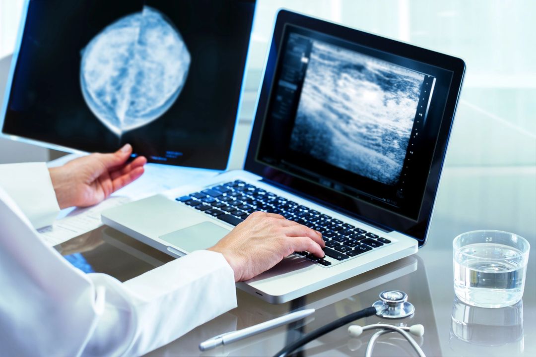In un contesto clinico, un operatore sanitario esamina le mammografie e un'immagine ecografica digitale su un computer portatile.