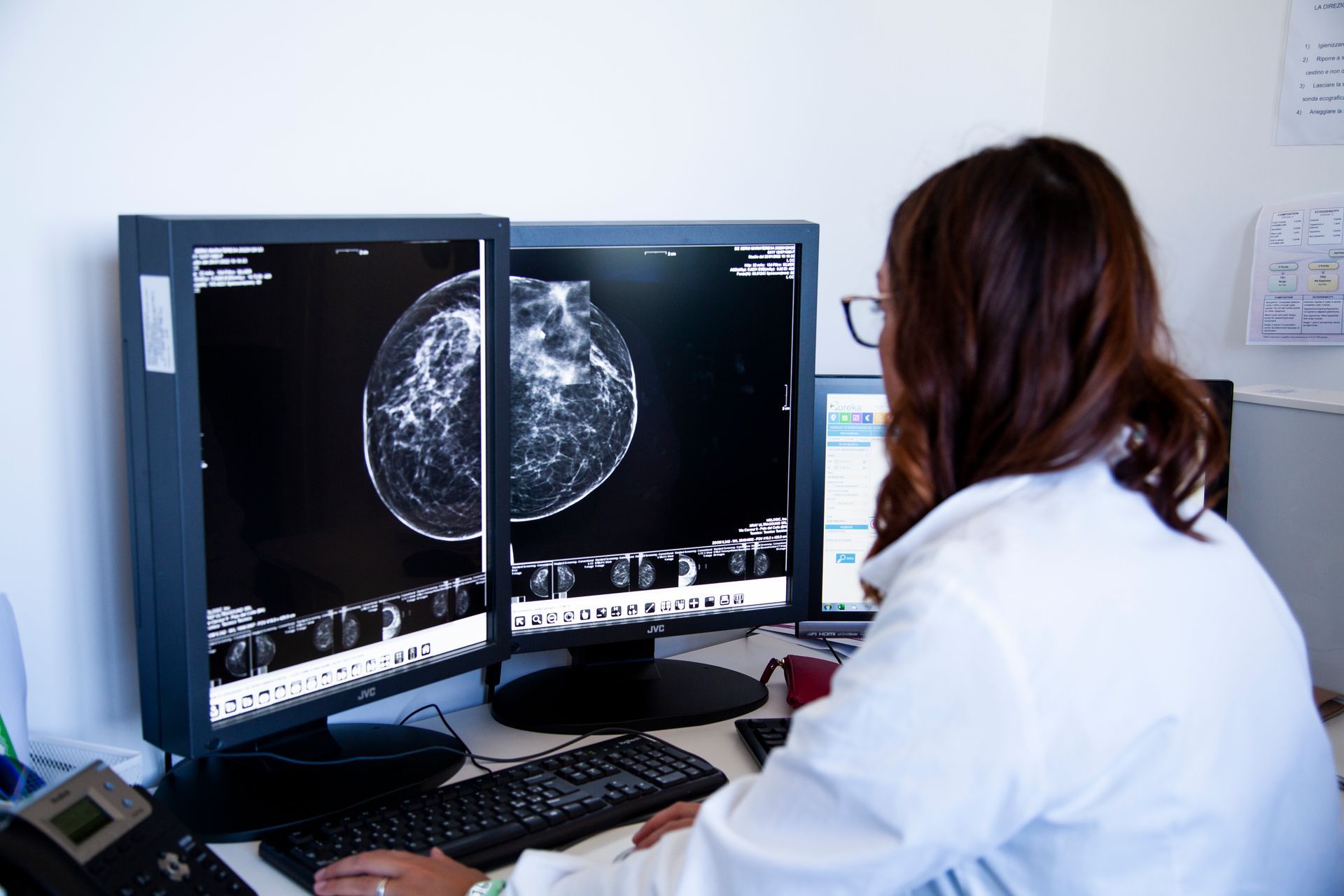 Un professionista sanitario in camice bianco esamina le immagini di una mammografia diagnostica su due monitor.