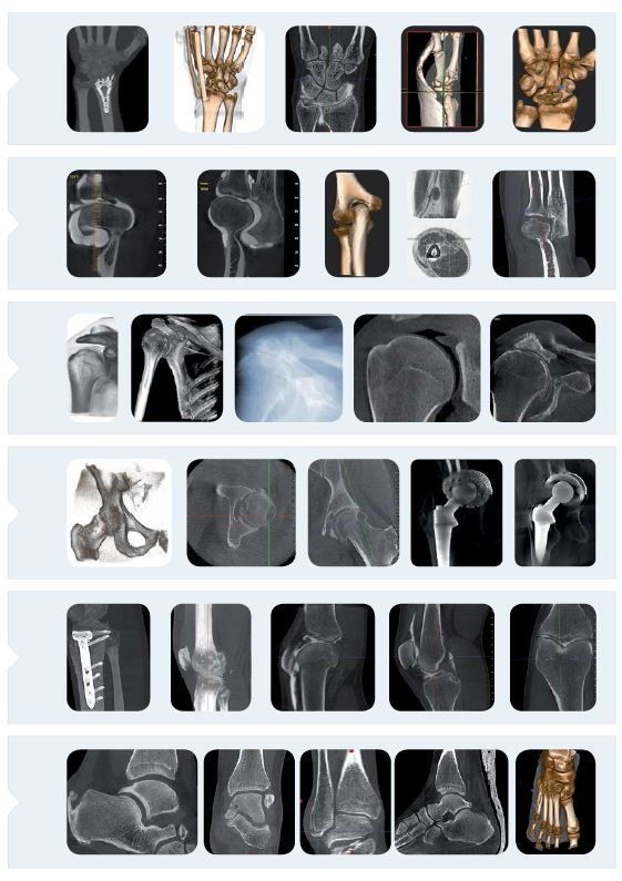 Una griglia di immagini diagnostiche, tra cui TAC e radiografie di varie articolazioni e ossa umane riprese da diverse angolazioni.