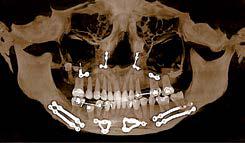rappresentazione radiografica cranio