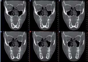 immagini radiografiche di un arto