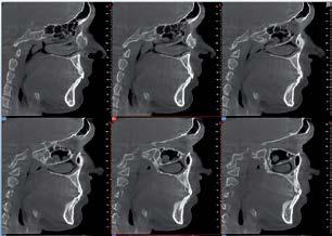 cranio in immagine radiografica