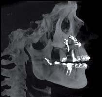 immagina radiografica cranio di profilo