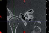 radiografia di un arto ad alta risoluzione