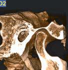 radiografia ad alta risoluzione