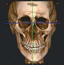 immagine radiografica 3d del cranio